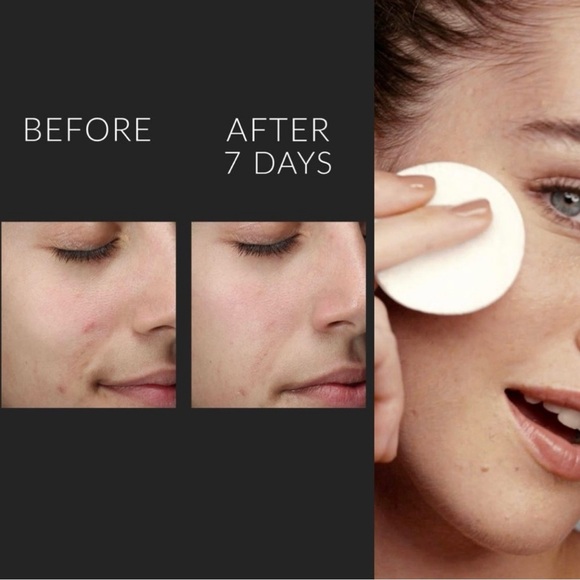 New KATE SOMMERVILLE Liquid ExfoliKate Tripple Acid Resurfacing Treatment - Picture 5 of 8